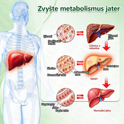 Oficiální prodejna BENU |  🧑‍⚕️𝐂𝐨𝐚𝐮𝐨𝐨® 𝐌𝐨𝐫𝐢𝐧𝐠𝐚 × 𝐁𝐞𝐫𝐛𝐞𝐫𝐲𝐧𝐚 × 𝐀𝐌𝐏𝐊 𝟏𝟎 v 1 – Zeštíhlující nano mikrojihlový náplast 🇨🇿 Jen 1× denně ✅ Viditelné změny za 7 dní – na obezitu, kardiovaskulární zdraví, diabetes a kloubní problémy