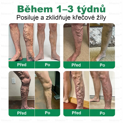🇨🇿👨‍⚕️✅✅Moauou® 𝐕𝐞𝐢𝐧 𝐓𝐚𝐫𝐠𝐞𝐭 𝐌𝐢𝐜𝐫𝐨𝐧𝐞𝐞𝐝𝐥𝐞 𝐏𝐚𝐭𝐜𝐡⚡Okamžitá úleva, dlouhodobé výsledky - Velký výprodej