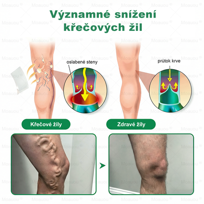 🇨🇿👨‍⚕️✅✅Moauou® 𝐕𝐞𝐢𝐧 𝐓𝐚𝐫𝐠𝐞𝐭 𝐌𝐢𝐜𝐫𝐨𝐧𝐞𝐞𝐝𝐥𝐞 𝐏𝐚𝐭𝐜𝐡⚡Okamžitá úleva, dlouhodobé výsledky - Velký výprodej