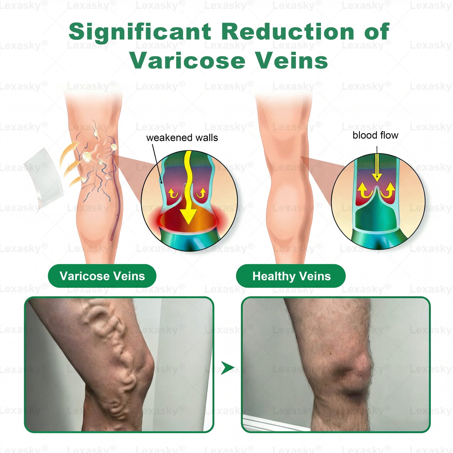 🇨🇿👨‍⚕️✅✅𝐋𝐞𝐱𝐚𝐬𝐤𝐲® 𝐕𝐞𝐢𝐧 𝐓𝐚𝐫𝐠𝐞𝐭 𝐌𝐢𝐜𝐫𝐨𝐧𝐞𝐞𝐝𝐥𝐞 𝐏𝐚𝐭𝐜𝐡⚡Okamžitá úleva, dlouhodobé výsledky - Velký výprodej