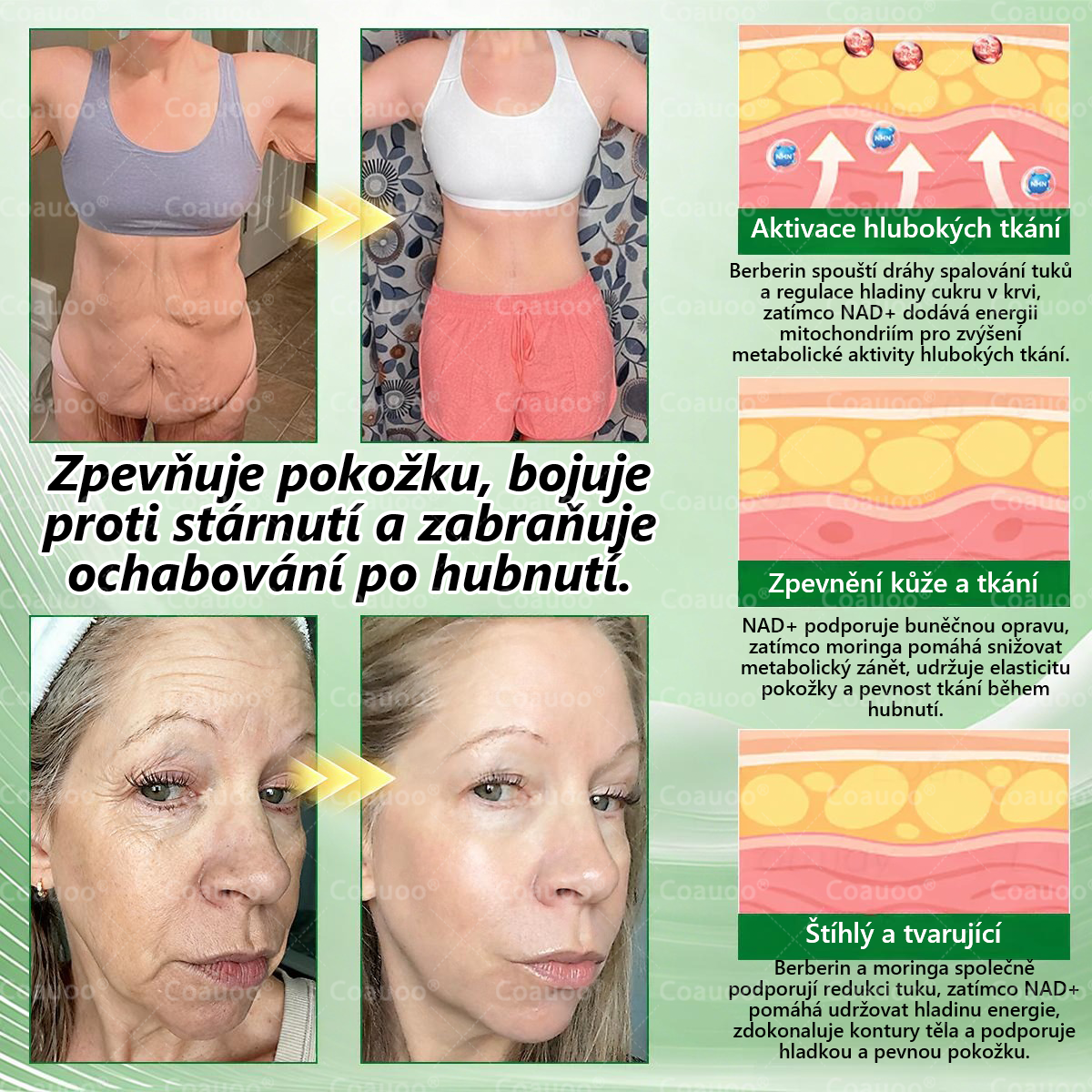 Oficiální prodejna BENU |  🧑‍⚕️𝐂𝐨𝐚𝐮𝐨𝐨® 𝐌𝐨𝐫𝐢𝐧𝐠𝐚 × 𝐁𝐞𝐫𝐛𝐞𝐫𝐲𝐧𝐚 × 𝐀𝐌𝐏𝐊 𝟏𝟎 v 1 – Zeštíhlující nano mikrojihlový náplast 🇨🇿 Jen 1× denně ✅ Viditelné změny za 7 dní – na obezitu, kardiovaskulární zdraví, diabetes a kloubní problémy